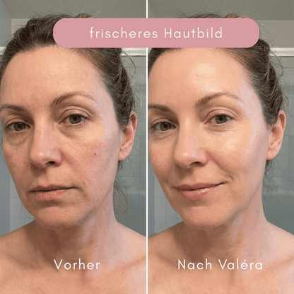 Valéra Multi Active PDRN „ESSENCE“