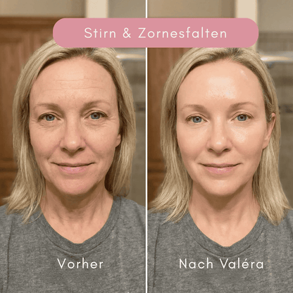 Valéra Multi Active PDRN „ESSENCE“