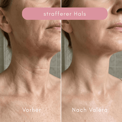 Valéra Multi Active PDRN „ESSENCE“